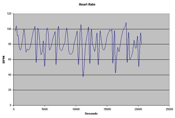 Data Acquisition Waveform - finished report showing heart rate